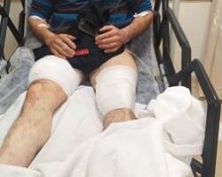 Korumalı: İŞİTME ENGELLİ GENÇ, BORÇKA’DA KIŞIN AYI SALDIRISINA UĞRADI